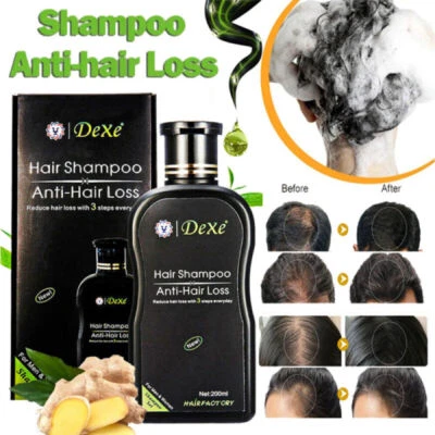 Fast Hair Growth Shampoo For Women Men Anti Hair Loss Treatment Care Thickening - Image 1 of 4