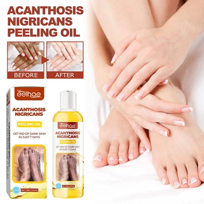 Oil Peeling For Skin Dark Whitening Remove Skin Dead Exfoliating Br Foto 1 de 4