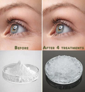 Pure Hyaluronic Acid Powder Sodium Hyaluronate AntiAging Wrinkle Joint Serum 5gm - Picture 1 of 6