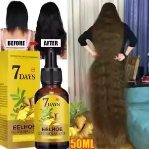 7 Day Fast Hair Growth Oil Ginger Growth Hair Treatment Anti Hair Loss Men Women - Picture 1 of 9