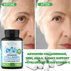 Collagen, Hair, Skin, Nails, Joint Support + Hyaluronic Acid & Vitamin C