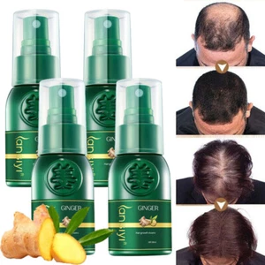 5 X Ginger Hair Growth Spray For HAIR REGROWTH Thickening Anti Hair Loss Serum - Picture 1 of 17