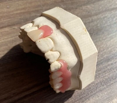 FLEXIBLE Dental FLIPPER - Image 1 of 4