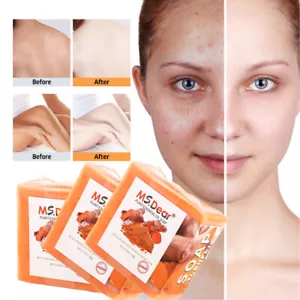 3PCS Sapone Tumerico Sbiancante Pelle Macchie Scure Schiarente Acne Curcuma - Foto 1 di 17