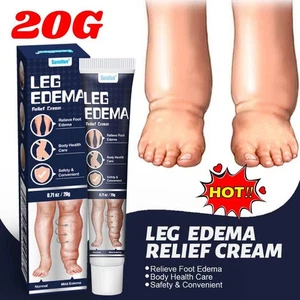 Leg Edema Relief Cream Effective Foot S wellin g Reduction Natural Ingredients - Picture 1 of 10