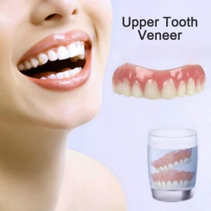 Perfect Smile Upper Veneer In Stock Whitening Tooth Care False Teeth Denture - Bild 1 von 7