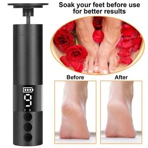 Electric Foot File Callus Remover 20 Discs Pedicure Tools Feet Sander Scrubber - Picture 1 of 41