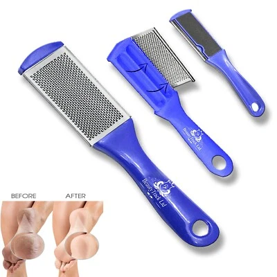 Foot Rasp File Callus Remover Scrubber Hard Dead Rough Skin Dual Sided Pedicure  - Image 1 of 4