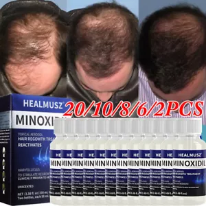 2-20 Meses de Stock MINOXIDIL 5% Suero Crecimiento Cabello PARA HOMBRES 50ML Nuevo - Imagen 1 de 28