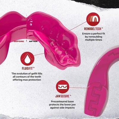 Protector Bucal Slim Fit Protector Bucal Para Adultos Jóvenes Con Estuche Boxeo Foto 1 de 4