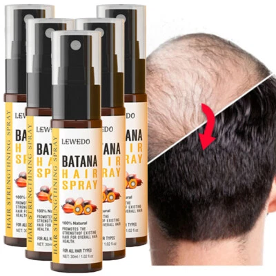 LEWEDO 5/3x Batana Oil Spray For Hair Growth, Anti Hair Loss Treatment for Men & Women