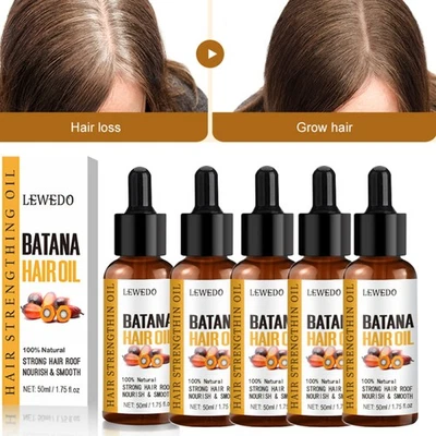 1-5* Batana Oil Organic for Hair Growth, Botana Oil Hair Growth Anti Hair Loss - Image 1 of 4