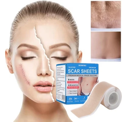 MEDICAL GRADE Scar Removal Tape Silicone Scar Sheet Treatment Patch 4cm x 150cm - Image 1 of 4