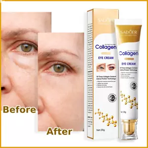 ✅ Unter den Augen Creme Entfernen Augenringe Tränensäcke Gesichtslinien Zeitlose Falten Geschwollene Augen - Bild 1 von 6