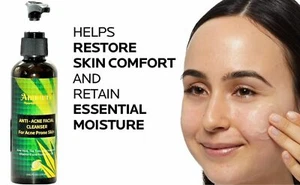 Ammuri Anti-Acne Cleanser with Aloe Vera, Tea Tree & Niacinamide - Deep - Picture 1 of 12