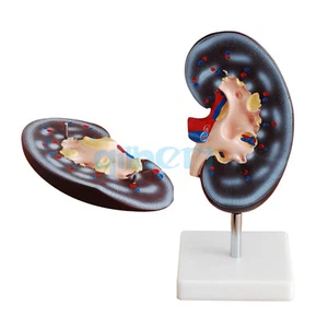 Modelo médico anatómico de riñón humano con glándulas suprarrenales 2 veces agrandado - Imagen 1 de 4
