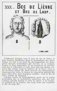 Cpa Series Alcoholism Drawings C. Houlbert Edit Mazo Xxx Circa 1911 - Picture 1 of 2