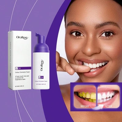 Mousse de limpeza profunda unissex espuma clareadora dental creme dental remoção de manchas dentes - Imagem 1 de 4