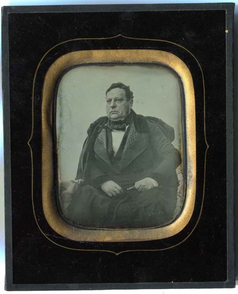 Niels Willumsen - Daguerréotype - Homme Maladie de Peau - Danemark -   - Photo 1/2