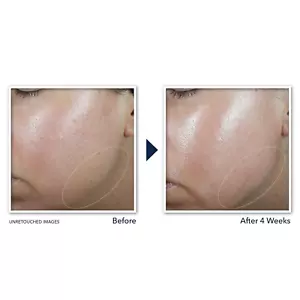 Derm Correxion Neck Cream with Hyaluronic Acid and Advanced Retinol to Visibl... - Picture 1 of 12