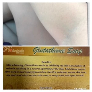 Glutathion Seife aufhellend Melanin Hyperpigmentierung Sommersprossen Alter und dunkle Flecken - Bild 1 von 3