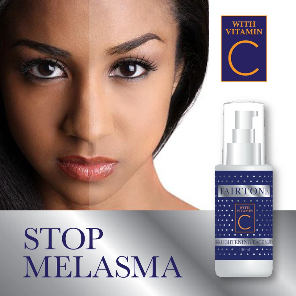 FAIRTONE SKIN LIGHTENING FACE SERUM WITH VITAMIN C FOR MELASMA PIGMENTATION