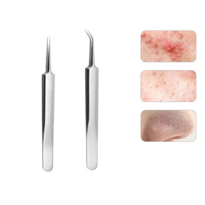 Herramientas extractoras de comedones de espinillas manchas espinillas removedor de acné facial de 1 pieza - Imagen 1 de 4