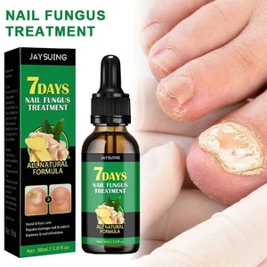 30ML 7 Days Nail Fungus Treatment Natural Formula Nail Toenail Care Liquid - Picture 1 of 14