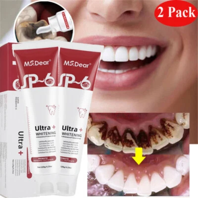 2X Sp-6 Probiotic Whitening Toothpaste, Deep Cleansing Care - Toothpaste 120g - Image 1 of 4