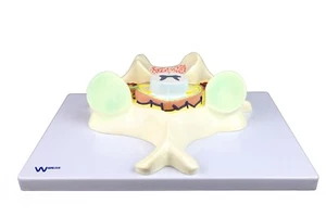 Parco Scientific PB00032 5. Halswirbelmodell (7-fache Vergrößerung) - Bild 1 von 7