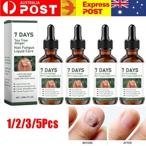 Tea Tree Ginger Nail Treatment 7-day Ginger Nail Growth Essence Repair Damage - Picture 1 of 17