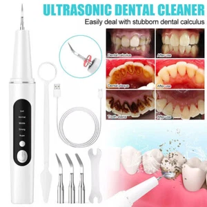 Electric Ultrasonic Tooth Cleaner Oral Teeth Stain Dental Cleaning Remover Kit - Picture 1 of 17