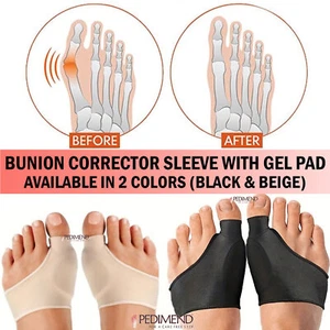 Pedimend™ Big Toe Straightener Hallux Valgus Pain Relief Sleeve with Gel Pad- UK - Picture 1 of 12