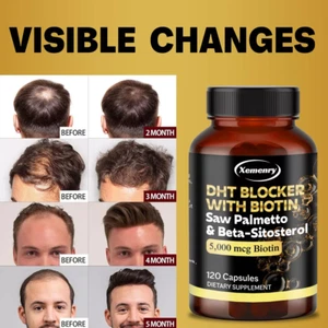 DHT Blocker 120 Capsule Biotina, Saw Palmetto, Beta-Sitosterolo, Aumenta la Crescita dei Capelli - Foto 1 di 8