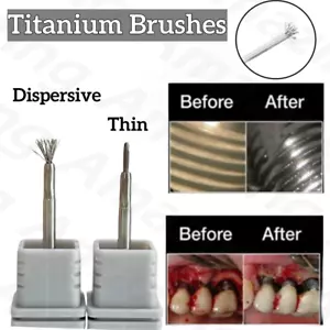 NUEVO Cepillo Dental Titanio NiTi Cepillos Periimplantitis Implante Cepillo de Limpieza - Imagen 1 de 11