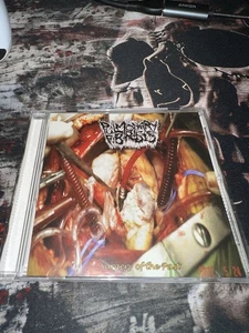 Pulmonary Fibrosis/ Pilocystic Astocytoma Split Goregrind - Picture 1 of 4