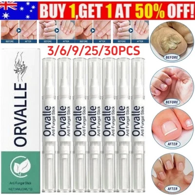 Orville Nail Fungus Pen Anti Fungus Infection Nail Care Repair Pen Toenail UK