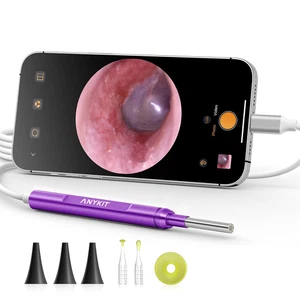 USB-C Digital Otoscope for Type-C Phone & Tablet, Ultra Clear View Ear Camera - Picture 1 of 12