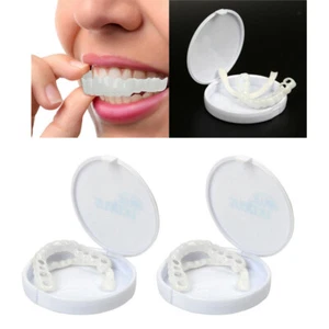 Ensemble de 2 facettes dentaires Perfect Smile Ensemble supérieur de mandrin