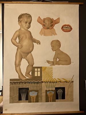 Alte Lehrtafel Rachitis Medizin Poster Vintage Studium • 118.05€