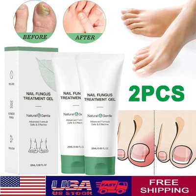 Nutraboost Nail Fungus Treatment Gel, Nail Fungus, Fungus Cream (2PCS) - Image 1 of 4