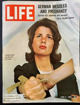 LIFE MAGAZINE Jun 4 1965 * German Measles and Pregnancy * Sculptor Rodan - Image 1 of 3