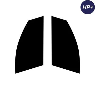 Para Smart Forfour 2005-2014 Carbono Precortado Ventana Tinte Frontal Premium HP+ Foto 1 de 4