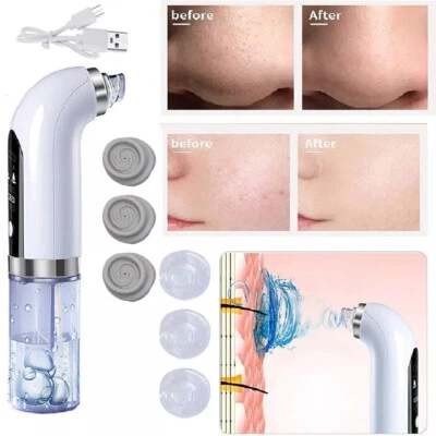 Vacuum Blackhead Remover Cleansing Machine Skin Pore Extractor Suction Cleaner - image 1 of 4