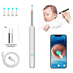 Ear Wax Removal Kit: Wireless HD Endoscope, Camera, Spoon & Pick Tools - Picture 1 of 16
