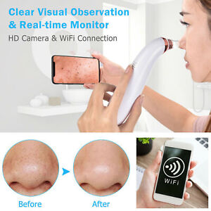 Electric Skin Pore Blackhead Cleaner Remover Vacuum Acne Cleanser With HD Camera