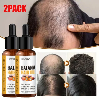 LEWEDO 2 X BATANA OIL Serum Natural Hair Growth Promotes Hair Regrowth For Women & Men