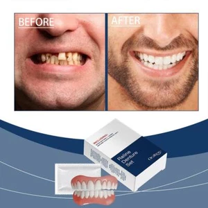 Denture Decoration Denture Set Enhance Smile Aesthetics Comfortable Material - Picture 1 of 17
