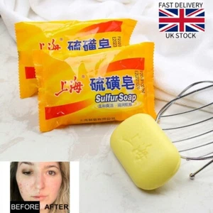 2 x Shanghai Sulfur Soap reduce Acne Skin Itching Cleaning Skin care Anti Fungus - Picture 1 of 5