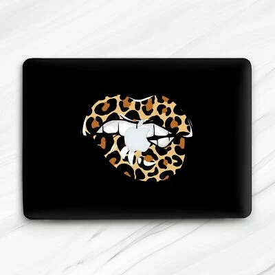 Estuche rígido negro moderno con labios con estampado de leopardo para Macbook Air 13 Pro 16 13 14 15 Foto 1 de 4